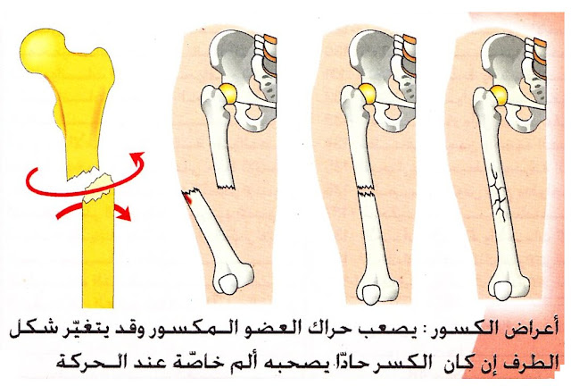الحوادث التي تصيب العضلات والعظام والمفاصل