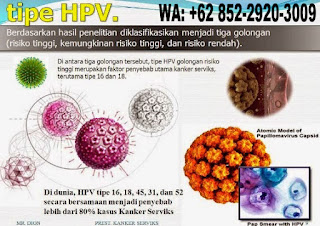 Obat kutil kemaluan kelamin obat kutil - di kulit kemaluan kelamin, penis pria laki-laki, vagina luar dan dalam, perempuan wanita Ibu hamil menyusui mengandung, obat penghilang kutil menghilangkan kutil tanpa operasi yang terbukti dan aman terpercaya, obat penghilang kutil di kelamin, anus dubur, paha dsb
