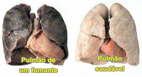 Eu fino se deixam de fumar