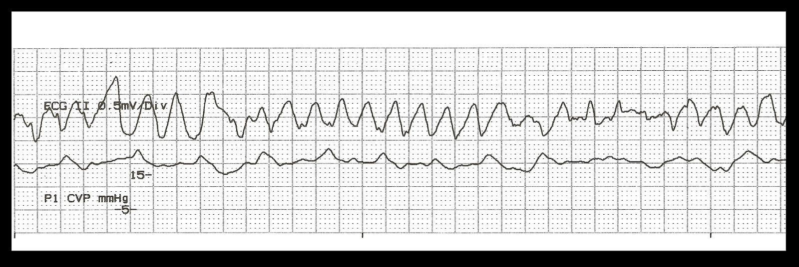 Float Nurse November 2014