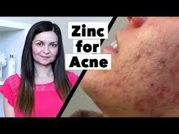 Zinc for Acne