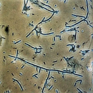 idrarda bakteri bulunması