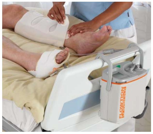 Pulmonary Embolism treatment akufisio.blogspot