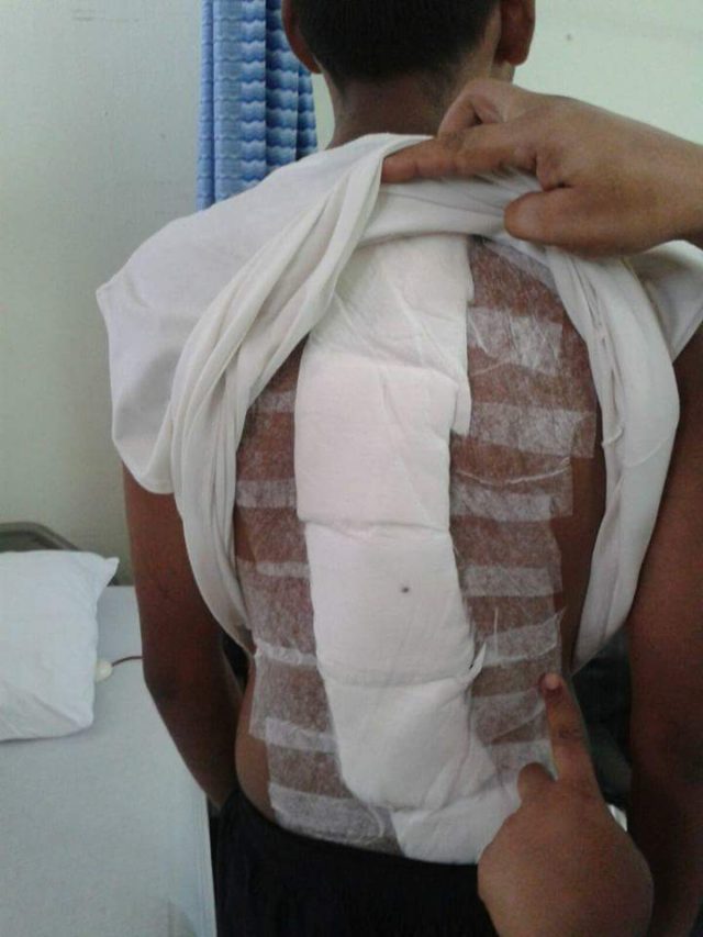 Obasa's blog STOP! THE EFFECT OF CARRYING HEAVY BAG ON CHILDREN'S BACK