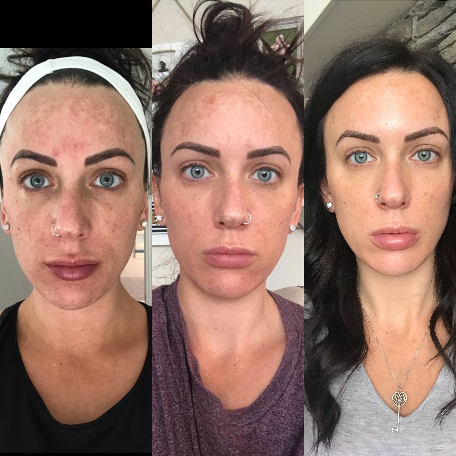 Makeup Artist's Choice Before/After Pics and Testimonials