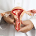 How to Cure Vaginal Itching and Burning?