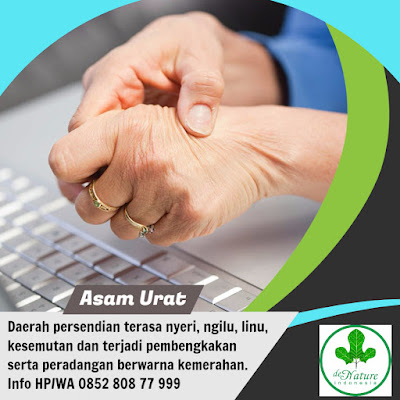 CARA MENGHILANGKAN ASAM URAT