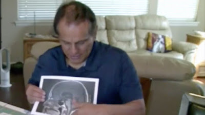 Tumor Otak Pria ini Tiba-tiba Hilang Karena Doa, Dokter pun Heran