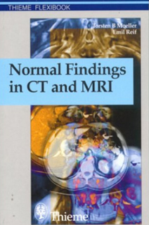 normal findings in ct mri