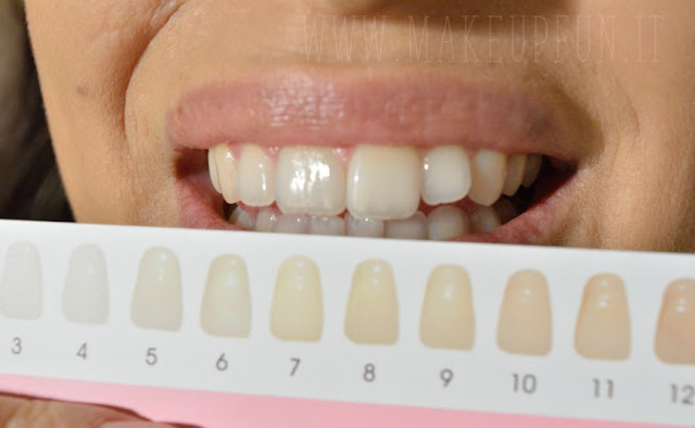 Whiten Your Teeth In 10 Minutes With HiSmile