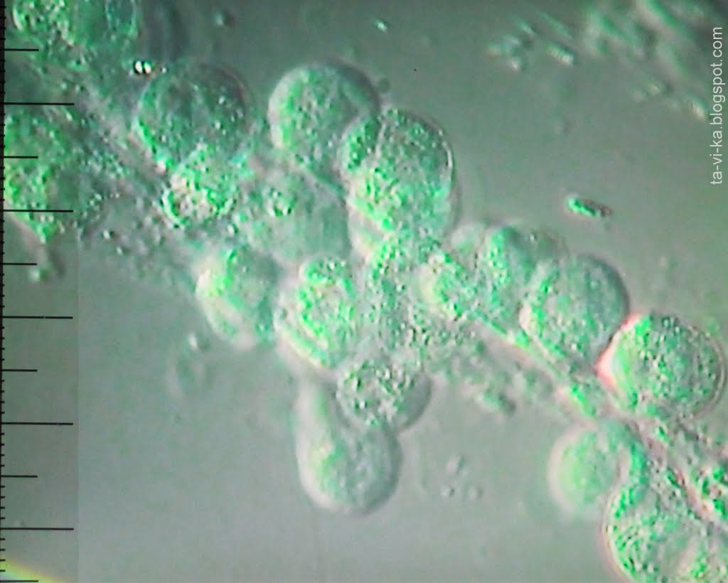 Бактерии в слюне. Слюна под микроскопом. Клетки слюны под микроскопом. Бактерии в слюне под микроскопом. Слюни под микроскопом.