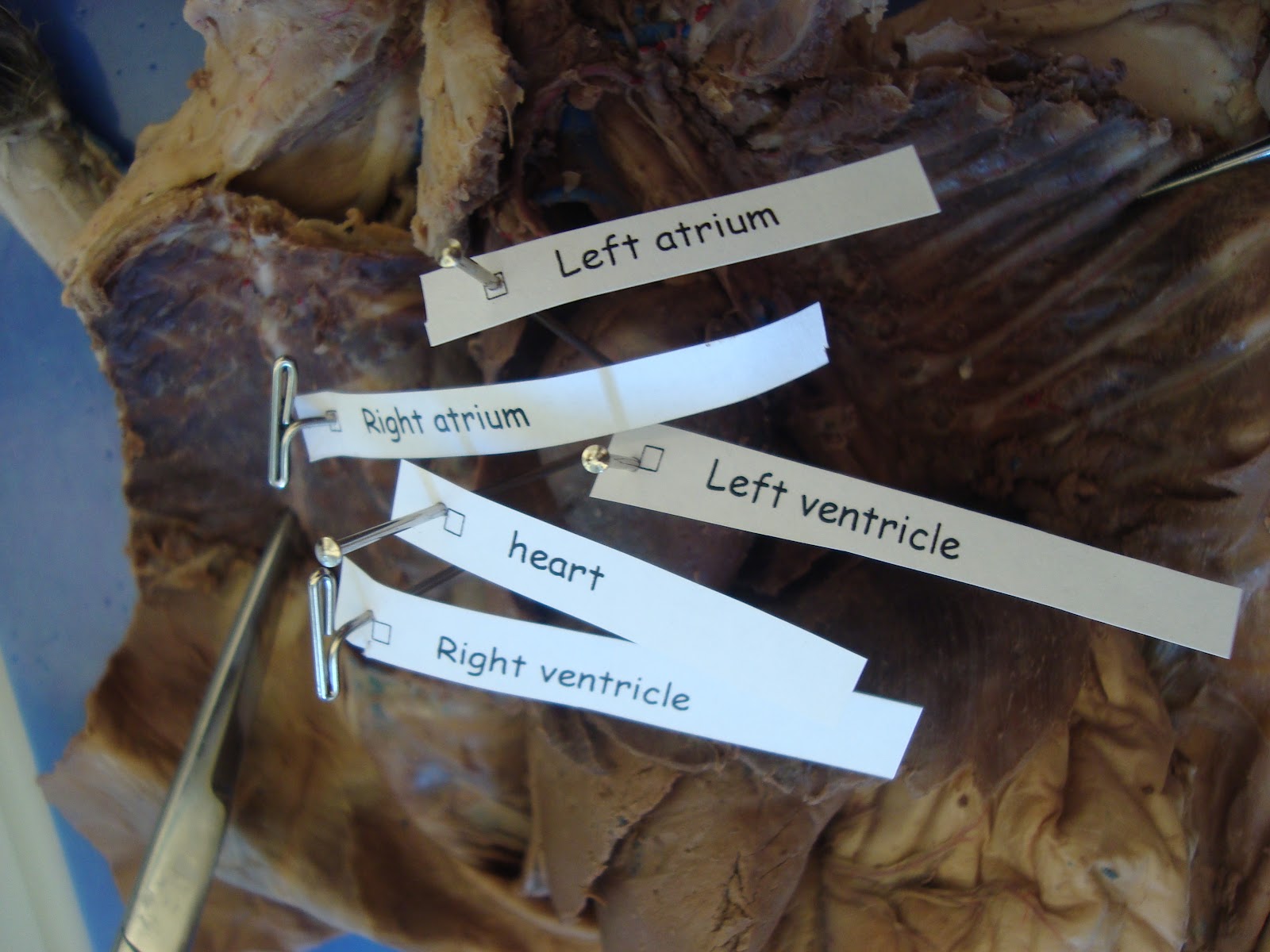 Cat Dissection: Human Anatomy: Cardiovascular System