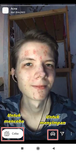 How To Get Acne Filters On Instagram 4
