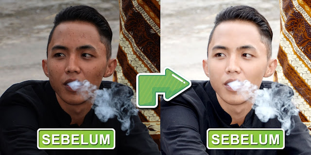 cara menghilangkan jerawat di foto dengan photoshop cara menghilangkan jerawat dengan cepat di photoshop
