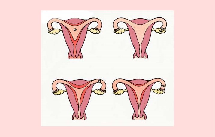 Sebutkan Tahap Tahap Aktivitas Pembentukan Sel Telur Dan