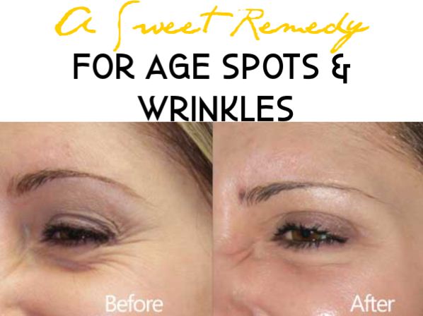 Homemade Remedy for Age Spots and Wrinkles