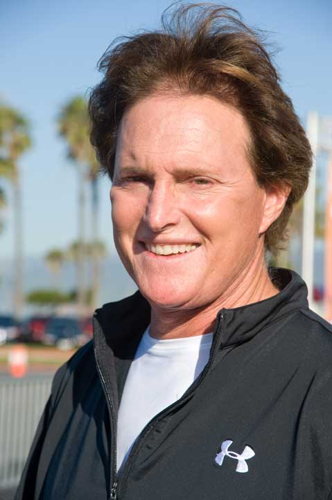 Bruce Jenner Plastic Surgery 2009