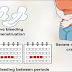 Amazing Tips and Tricks On How To Remove Myomas Naturally And its Signs