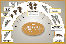 Kutu Kepala Ubat Kutu Rambut - Cara Menghilangkan Kutu Rambut Pakai