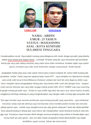 Cara Menghilangkan Benjolan Lunak Di Pipi Dekat Telinga Secara Alami Cara Menghilangkan Benjolan Lunak Di Pipi Dekat Telinga Secara Alami