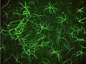 Teadvusehuvi: Neuronite võrdlus teiste rakkudega ja veidi taustbioloogiat