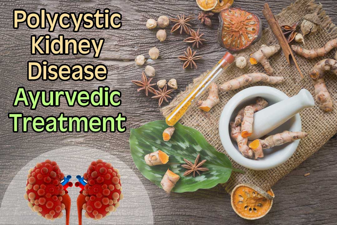 Ayurvedic Kidney Care Guaranteed No Stress POLYCYSTIC KIDNEY DISEASE