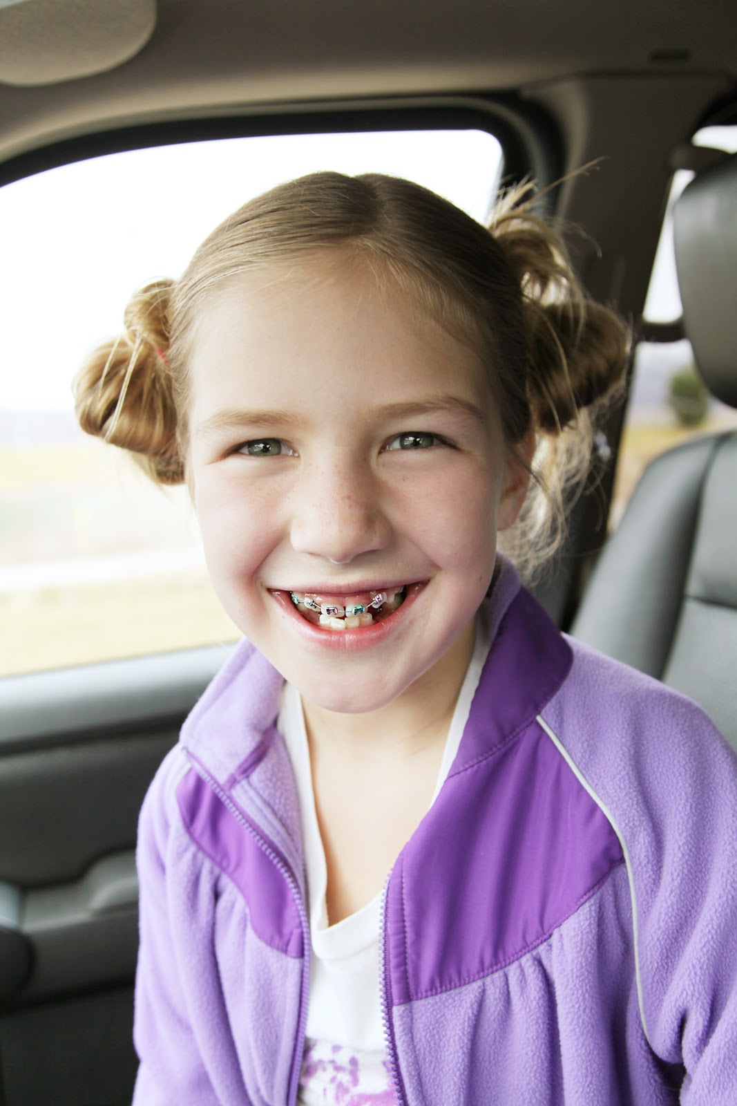 The Lighten Family Blog BraceFace