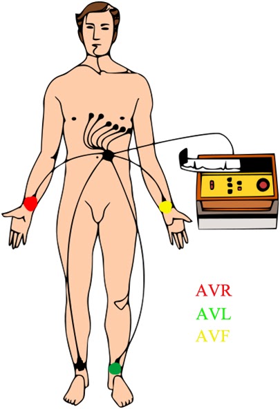 Urgencias Y Emergencias Extrahospitalarias Electrocardiografía Básica Colocación De Electrodos