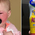 FOX: Banana Boat sunscreen caused toddler’s second-degree burns, mom says