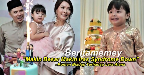 Makin Besar Makin Iras Syndrome Down Gambar Birthday Lara Alana Dicemari Kutukan Mulut Puaka Berita Memey