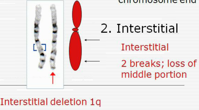 Aiden's Heroes- Autism Blog: Understanding Genetics: Chromosome 15