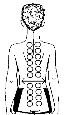 Схема банок на спине. Схема размещения банок на спине. Схема постановки вакуумных банок.