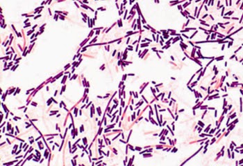 Clostridial Disease of Sheep and Cattle - Vet in Training