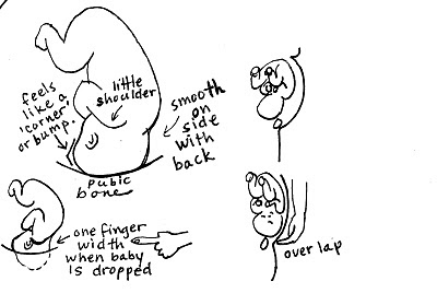 Spinning Babies Engagement of the baby into the pelvic inlet (brim) is important because to fit through the pelvis, baby has to get into the pelvis first. Engagement is when the widest part of baby's head enters the true brim of the pelvis.