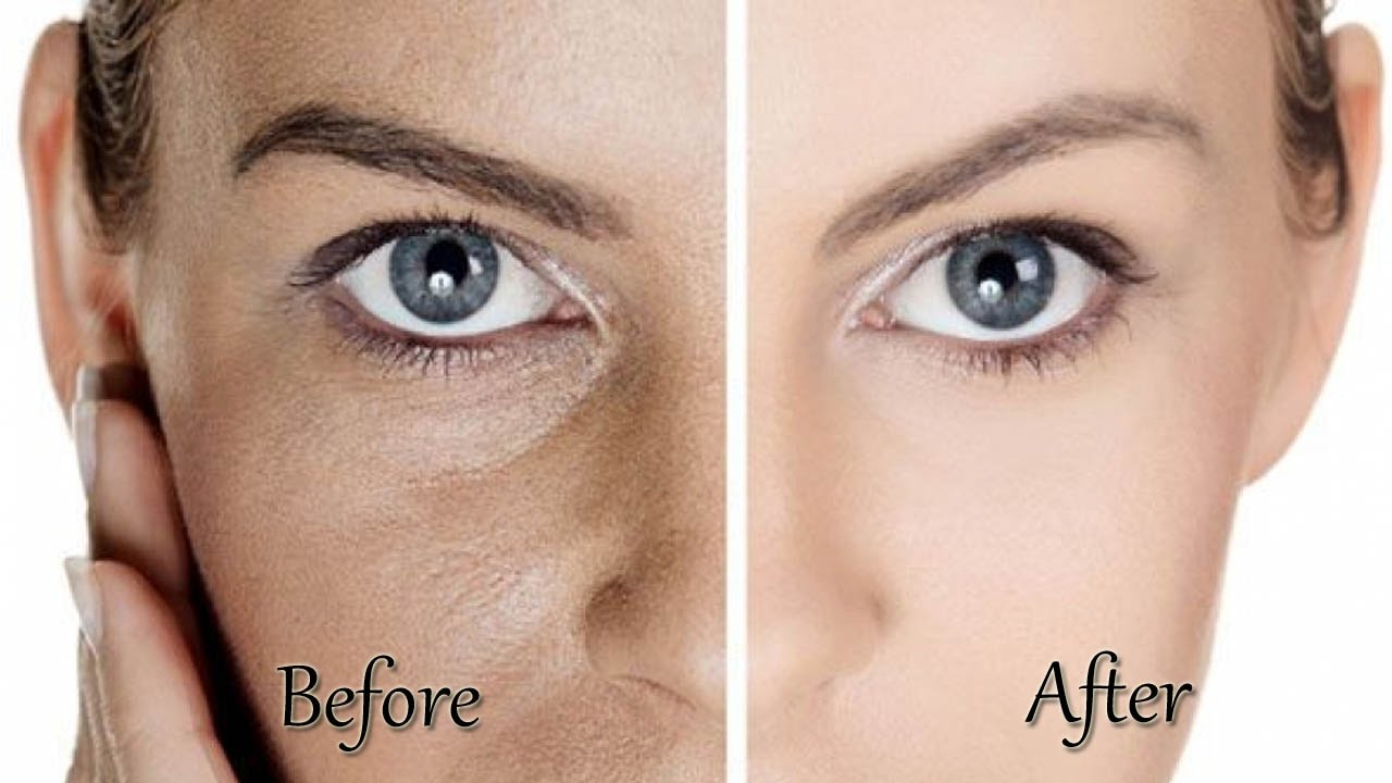 How to get rid of enlarged pores