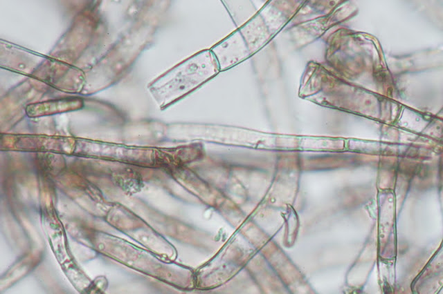 Resultado de imagen de hifas de hongos al microscopio