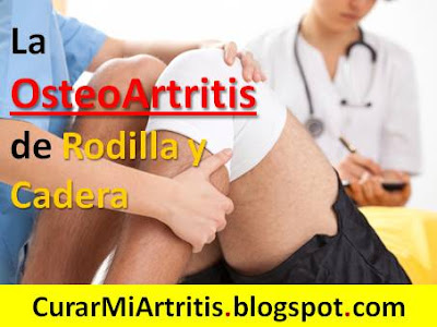 La-Osteoartritis-de-Rodilla-y-Cadera-tratamiento-natural