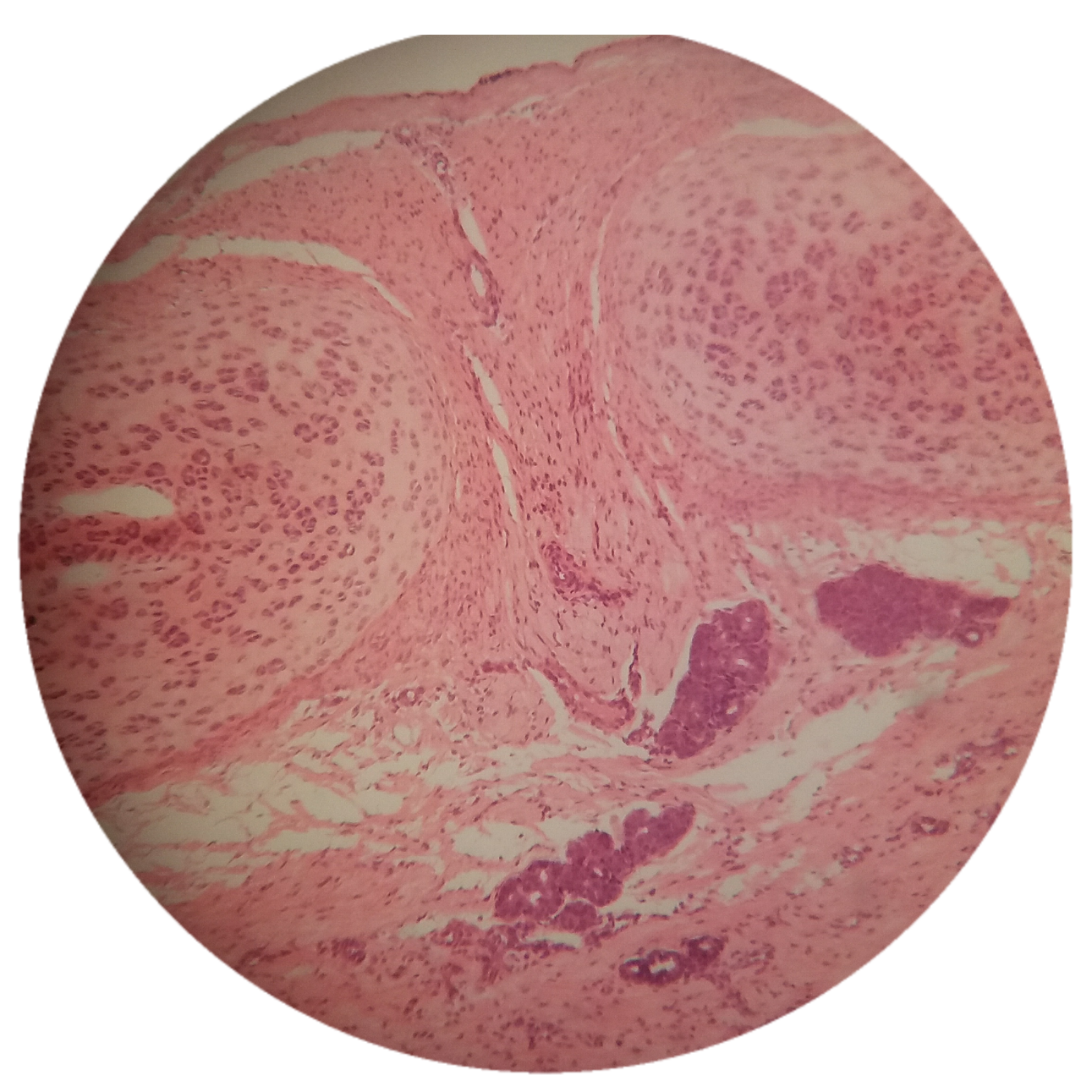 NUTRIMÉTRICO: Histología del Pulmón