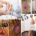 AMBEJOSS 50 kapsul Anti Wasir dan Ambeien thumbnail