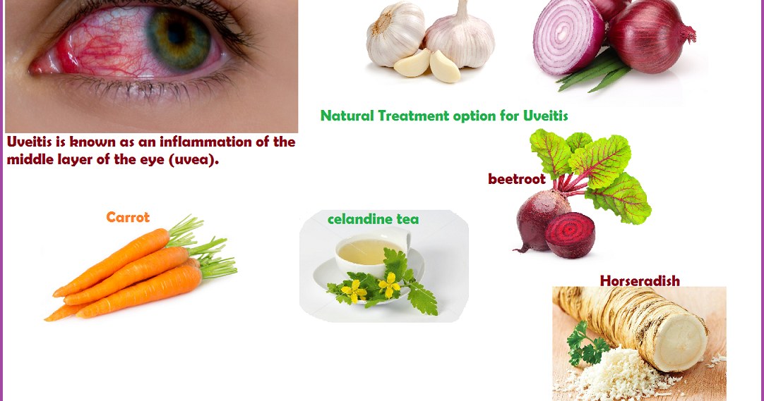 Cataracts Treatment Naturally Cataracts Treatment Naturally