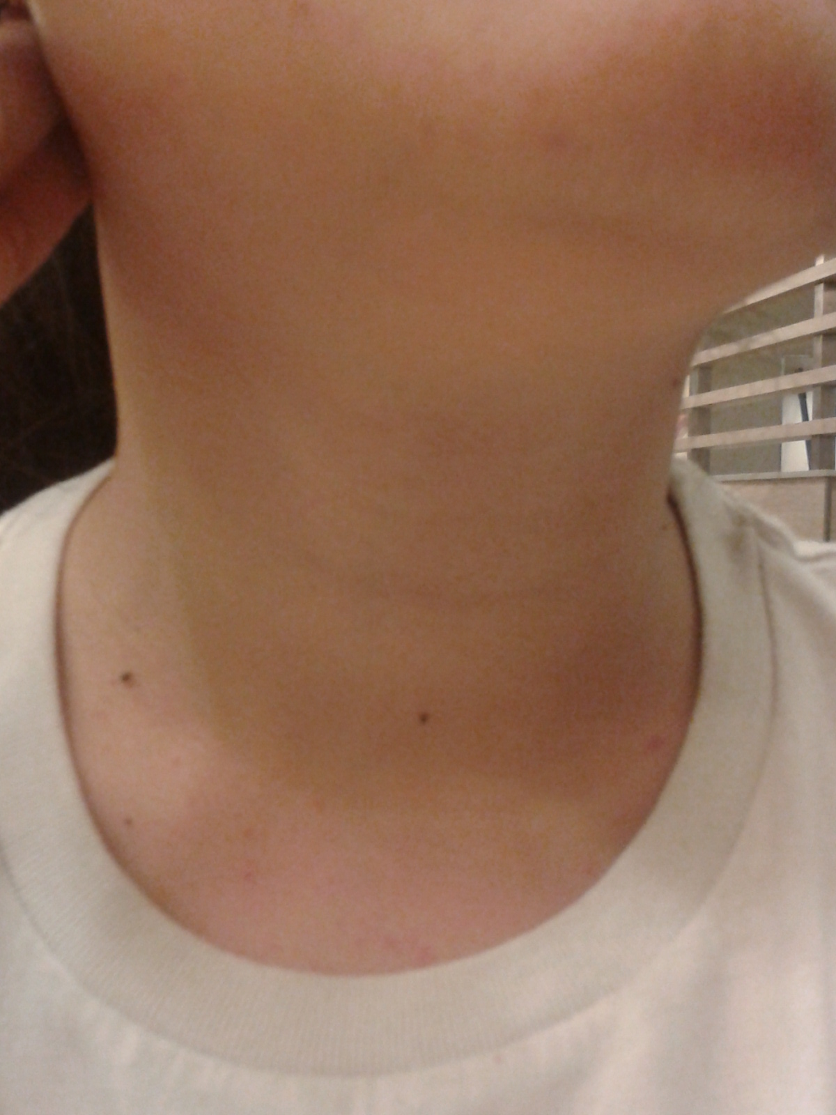 Karishma Kapoor Ki Nangi Photo Lines on neck meaning