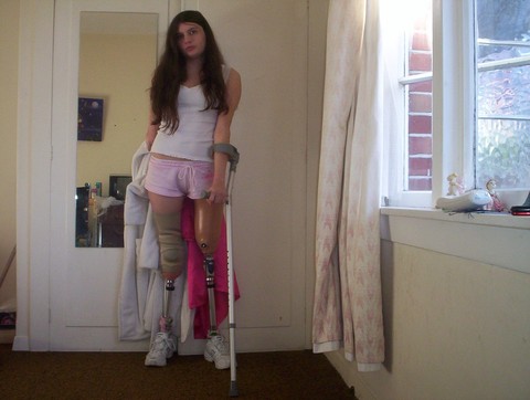 Девушка Без Ноги Знакомство Хадб