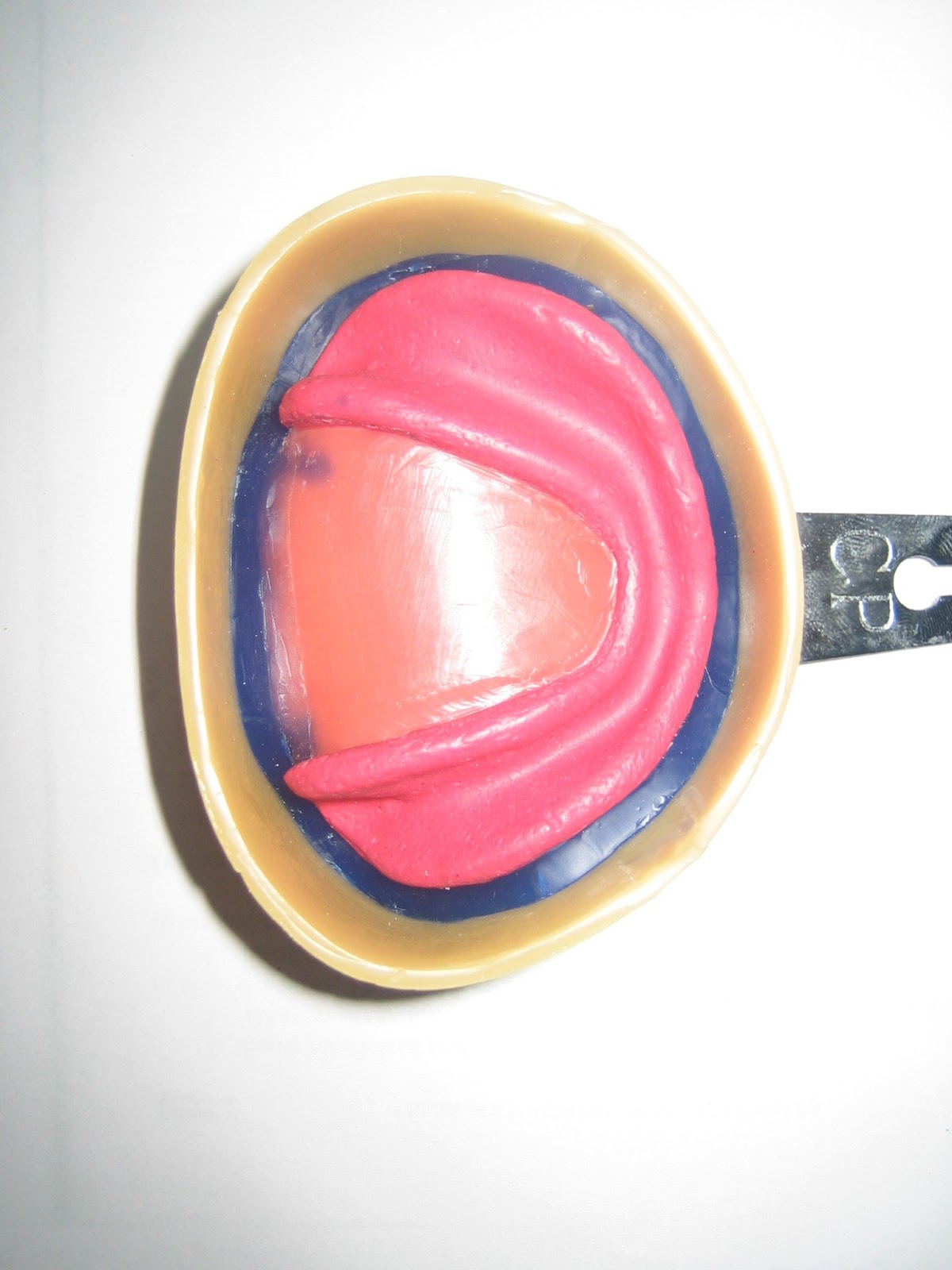 Understanding Prosthodontics Tagore Dental College & HospitalBy