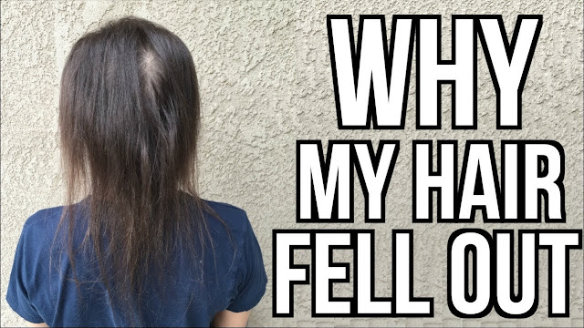 hair fall mistakes,common mistakes of hair fall,solution of hair fall control hair fall,stop hair fall,main mistakes of hair loss