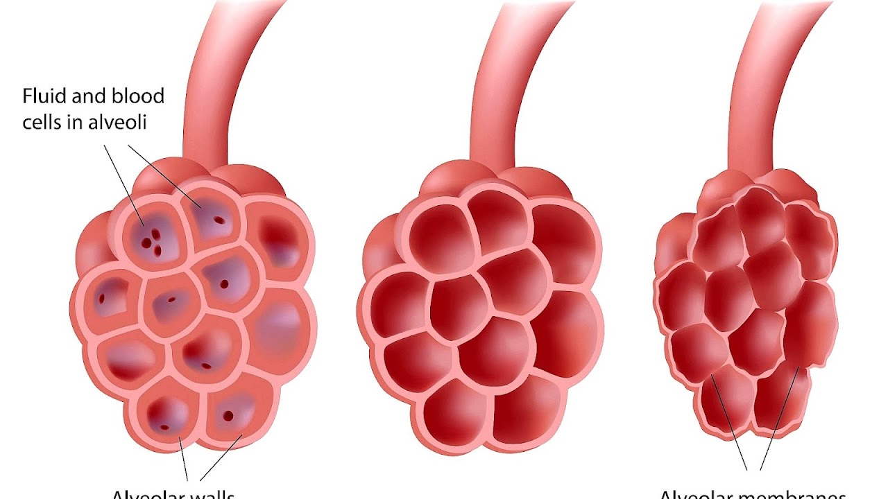 Coughing Yellow Mucus Causes Picture Symptoms Treatme vrogue.co