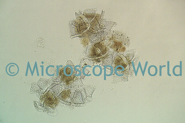 Phytoplankton under the microscope at 40x.