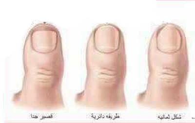 نرعاك تقليم قص الأظافر للطفل