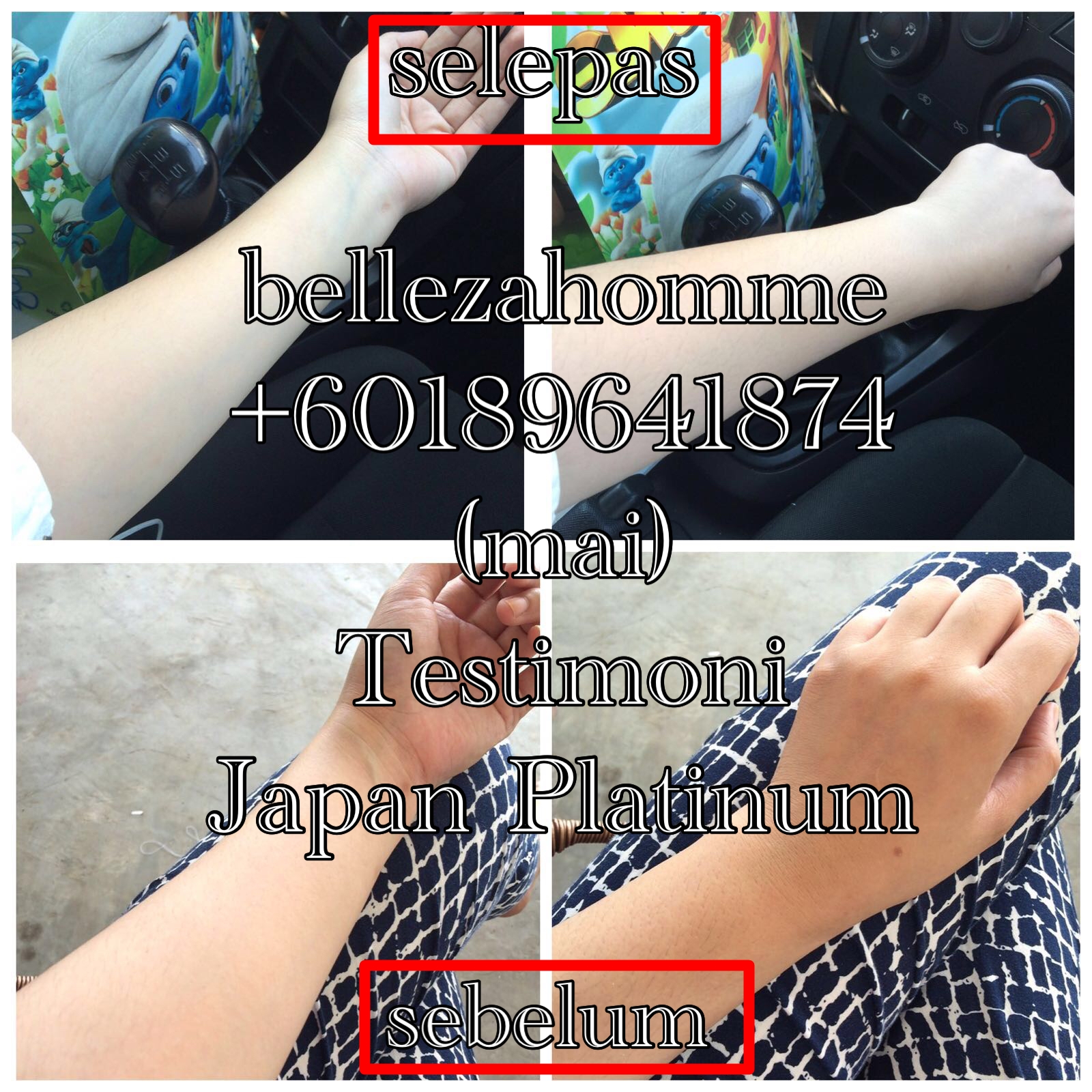 . JAPAN PLATINUM WHITENING INJECTION / GOLDEN WHITE WHITENING INJECTION