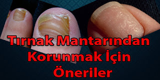 tırnak mantarından korunmak için öneriler tırnak mantarı nasıl geçer