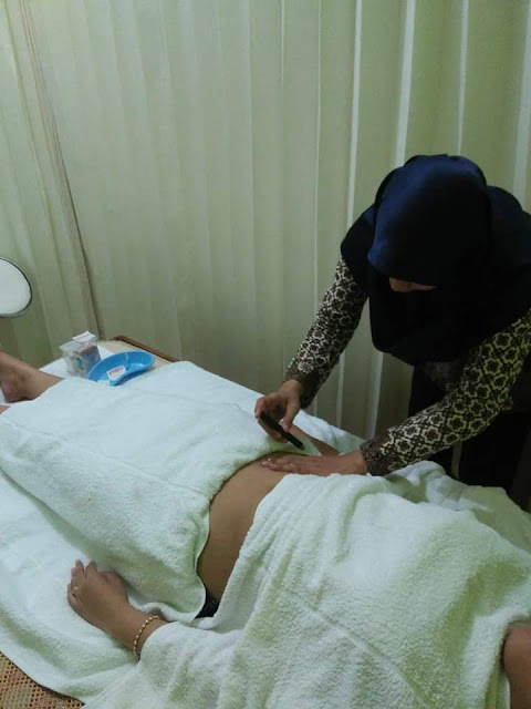 Proses Terapi Akupuntur untuk tuba falopi non paten di Klinik Holistik Elif Medika Proses Terapi Akupuntur untuk tuba falopi non paten di Klinik Holistik Elif Medika